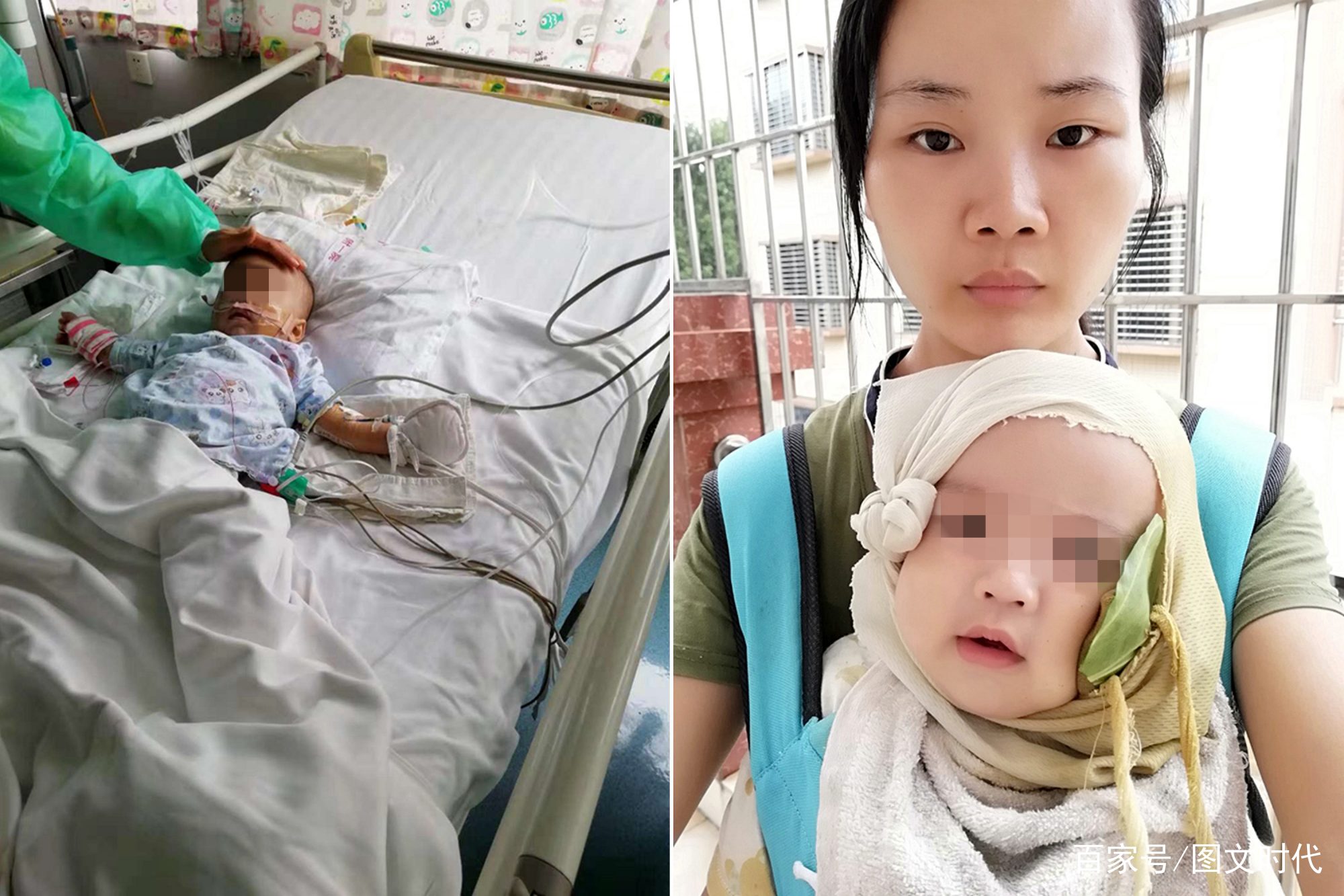                     男婴脸上长了一个红疙瘩，后被切除半张脸，10天后又确诊癌症