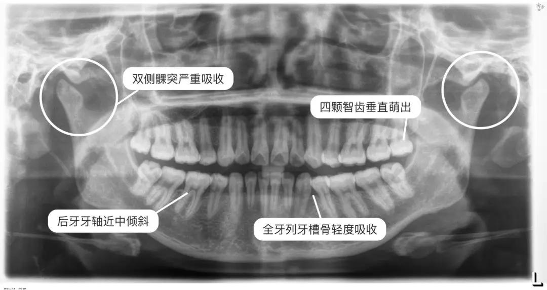 "牙齿矫正初诊就要拍片?我看你想骗我钱!