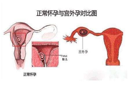 4143b427cdac4d4d82f3bedcf056c1ab.jpeg