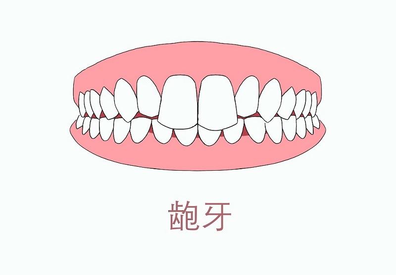 原创牙齿6大不好看你是其中一个吗