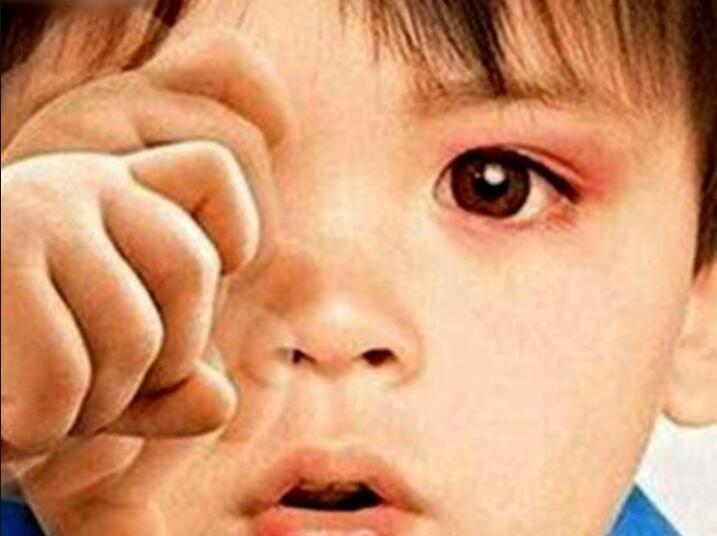                     4岁男孩“哭”了一整年，怎么哄都不见效，医生：怎么才来看啊？