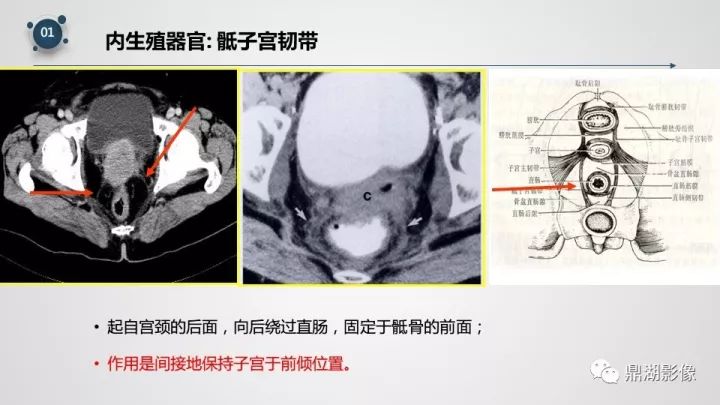 精品推荐 | 子宫附件影像解剖