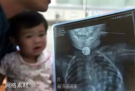                     养大一个孩子会遇到多少意外状况？心理素质弱点的都扛不住啊......