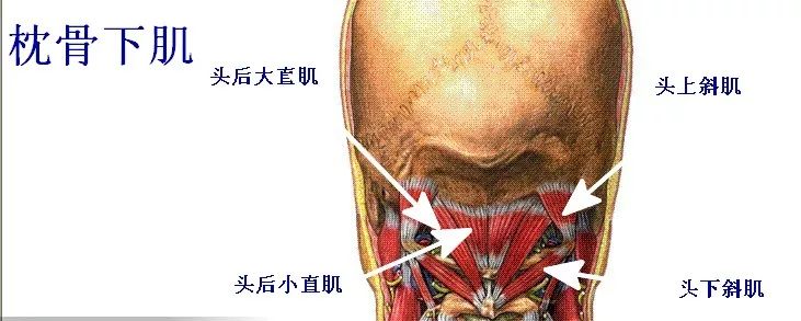 枕骨下肌—枕骨下肌包括头上斜肌,头下斜肌,头后大直肌,头后小直肌