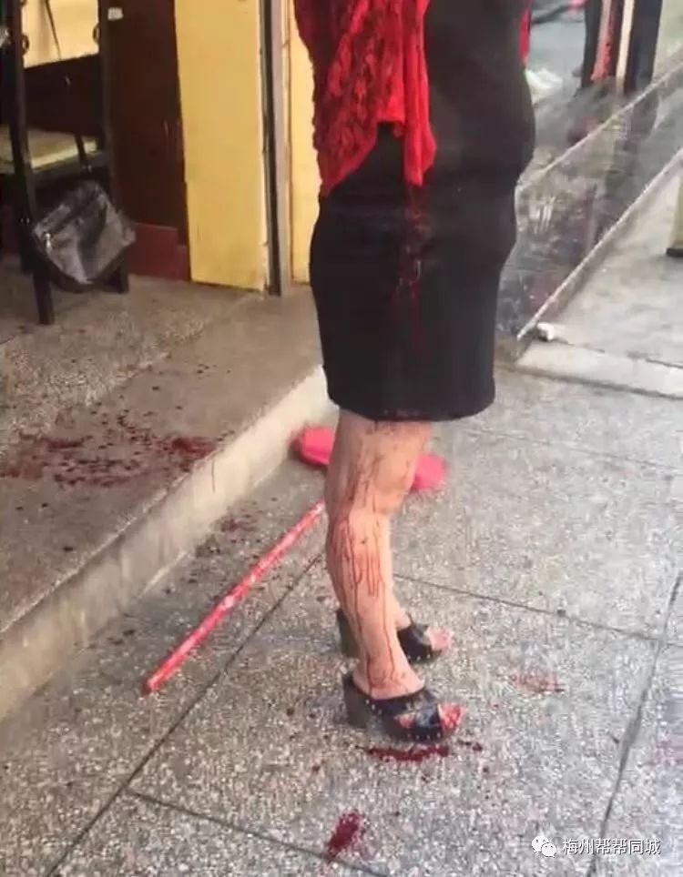 梅州31岁男子当街用砍刀砍伤49岁女子……所为何事?
