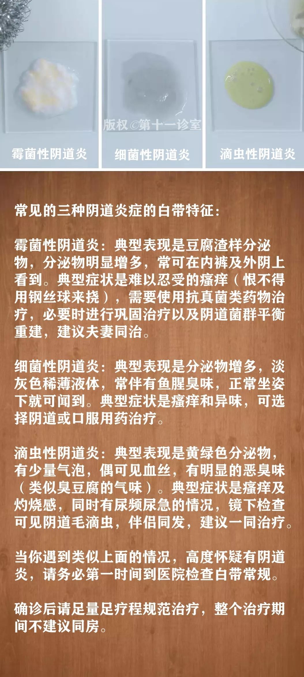 姑娘,关于白带的这些知识,你必须知道!