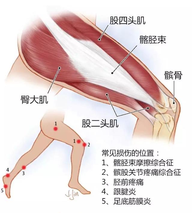 受伤如何缓解疼痛 b66aaa7698b54b6091467be8a11f67a8.jpeg