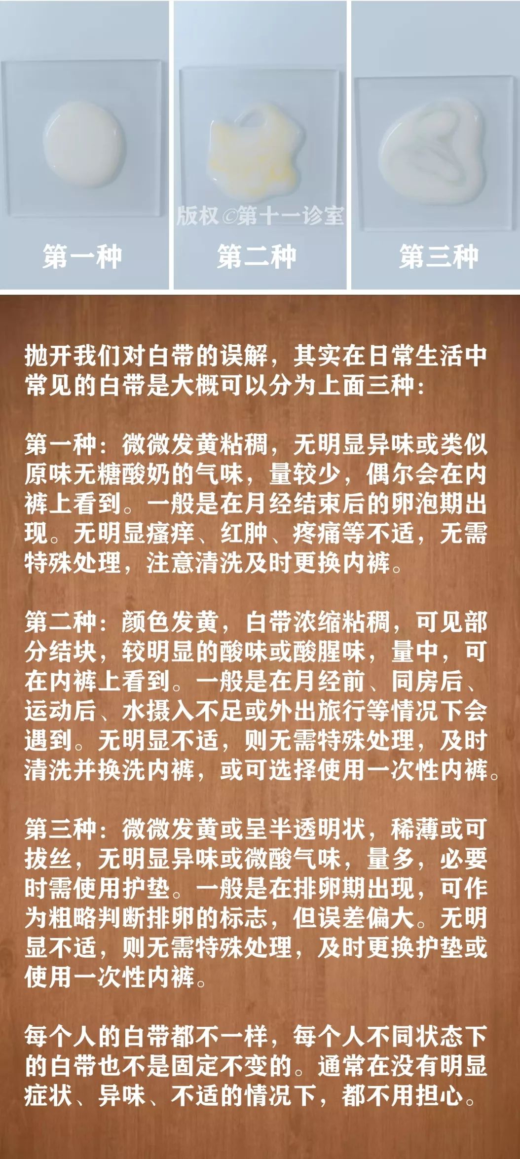 姑娘,关于白带的这些知识,你必须知道!