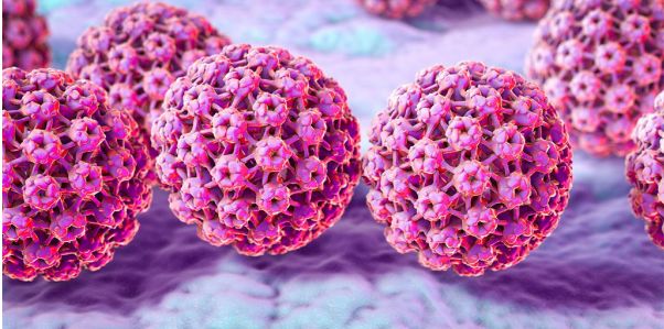 hpv病毒是什么引起的怎么治 0be65b2cf38d4f90b9e4f9a4a9d06995.jpeg