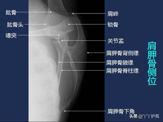 常规x线影像解剖大全