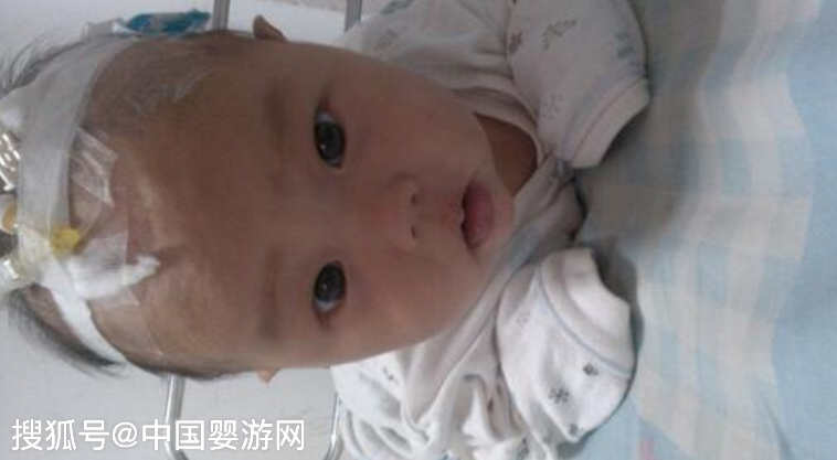                     宝宝轻度肺炎该怎么护理？ 建议收藏！
