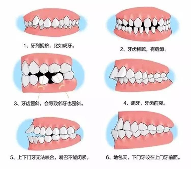                     原创            吃手是宝宝聪明的表现？到了这个年龄一定要戒，不然脸就毁了