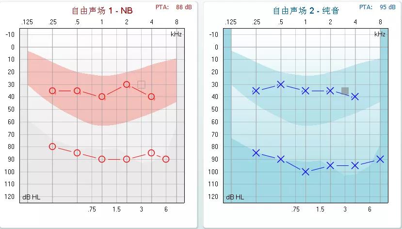 有一些孩子听力不重,助听器补偿效果也不错,都在香蕉图上端,但在语训