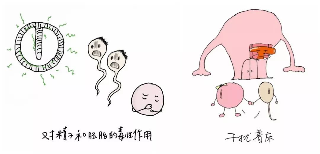 【高阳妇幼科普】医生和您聊聊科学避孕那些事儿之"宫内节育器避孕"