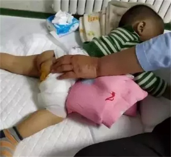                     惊！孩子玩滑梯脚崴成180度，只因妈妈这个动作！很多家长做过！
