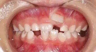 吃什么东西对牙齿有益 3eec368482914e4dbca24636ba5bb8c8.jpeg