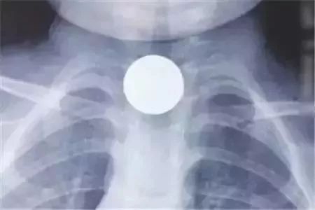                     宝宝哭闹不止，哄也没用？孩子的这11种哭闹，你搞懂原因了嘛？