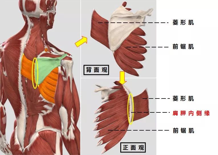 常见的位置大多在沿肩胛骨内侧缘靠下的位置,这里也是菱形肌和前锯肌
