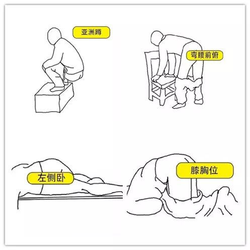 除非病情需要,才采用其他体位