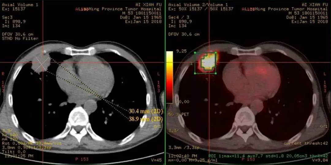 什么是基因突变的肿瘤 756b73e519734ab59d6d877498695899.jpeg