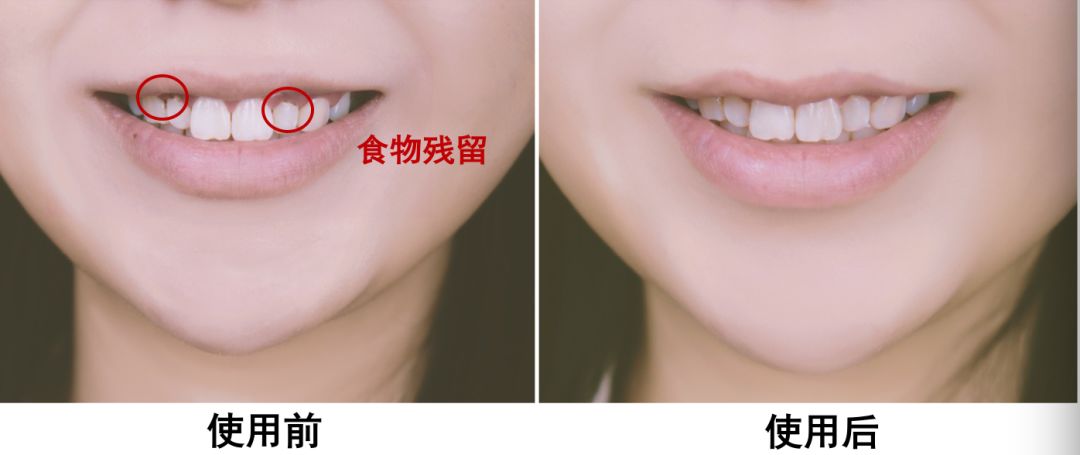 哪些东西可以让牙齿变白 afec447ebf514ab6b204f4d489b94e52.jpeg