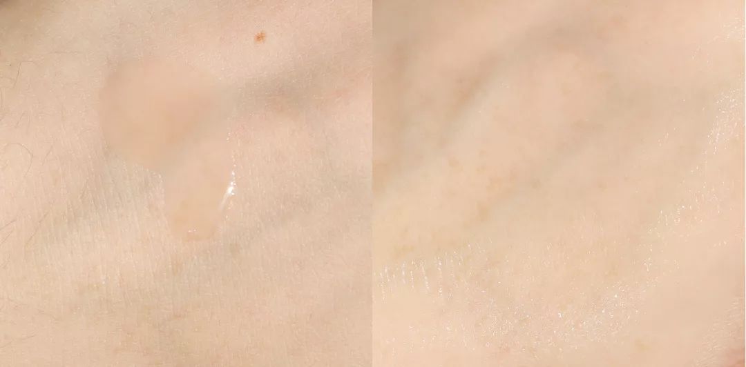 怎么样才能不长痘痘和闭口 cc3dc844f54246c1a8b7289598667862.jpeg