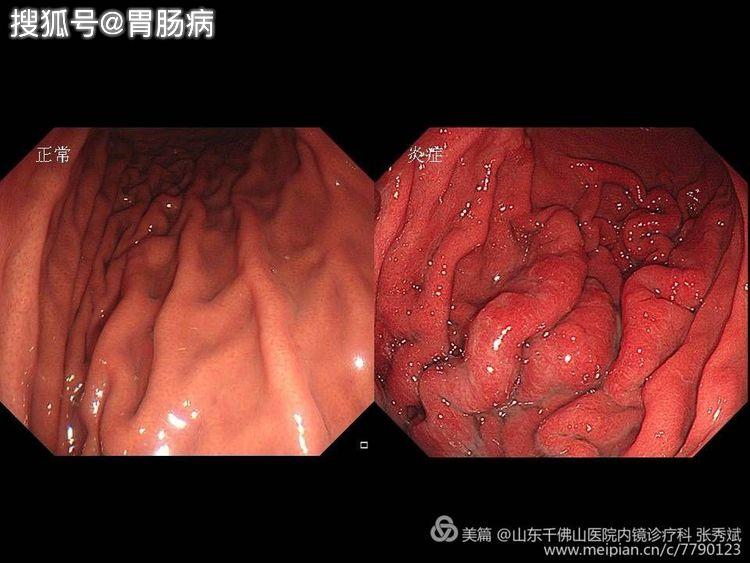 cce3d581fa5d46799f120454c8ab6196.jpeg