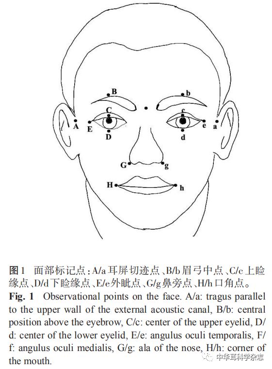 面瘫患者健侧面部动静态指标的三维测量分析