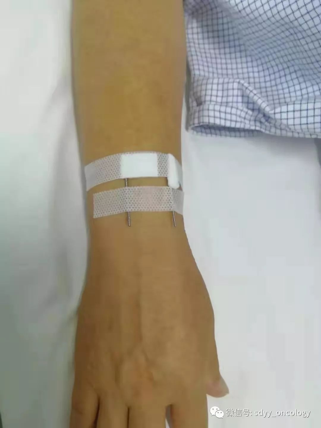 医用留置针贴-安徽省小山卫生材料有限公司