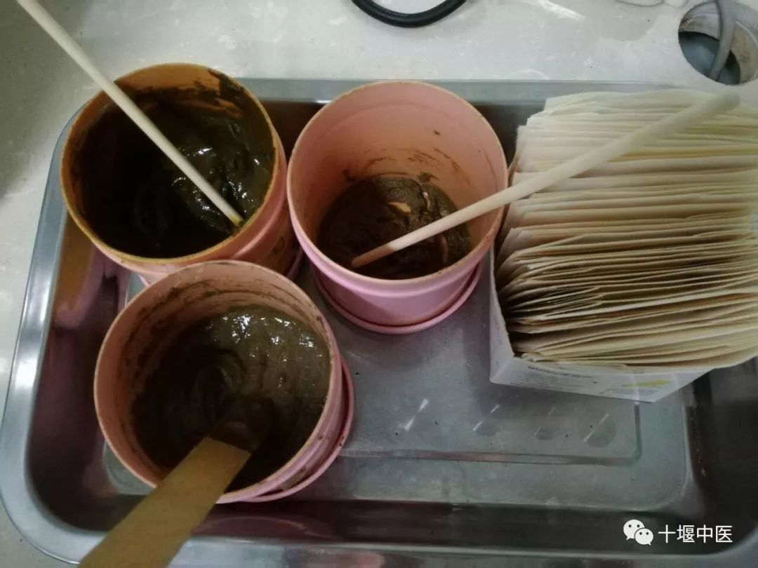 (中药帖敷制剂)