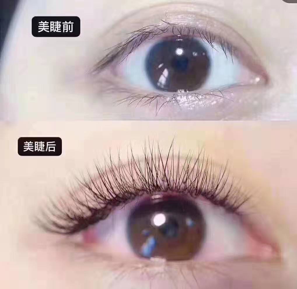 其实真睫毛是生长的,本身每天也会有脱落,所以,只要正常保护,是没