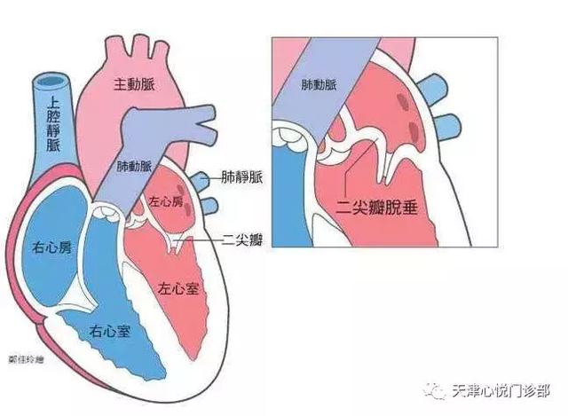 关于心脏二尖瓣异常的中医辨治