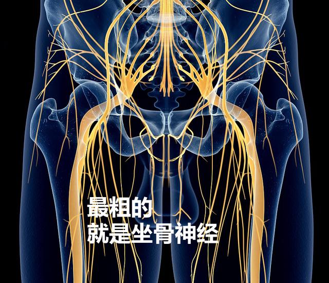 1分钟了解坐骨神经痛