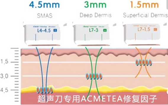 美容超声刀原理是什么_白带是什么图片