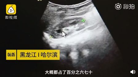                     被迫性早熟的9岁孩子