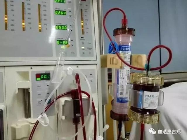 不同血液灌流器预冲方法探讨研究