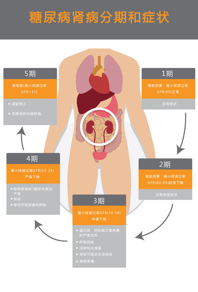 尤其是有贫血症状的2型糖友, 还伴随尿量减少或是没有尿的情况 这类