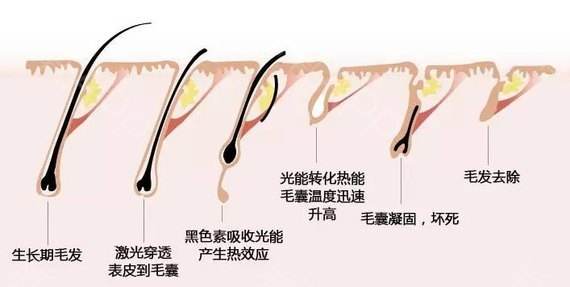 激光梳的原理_图表3:频率梳技术原理.(2)