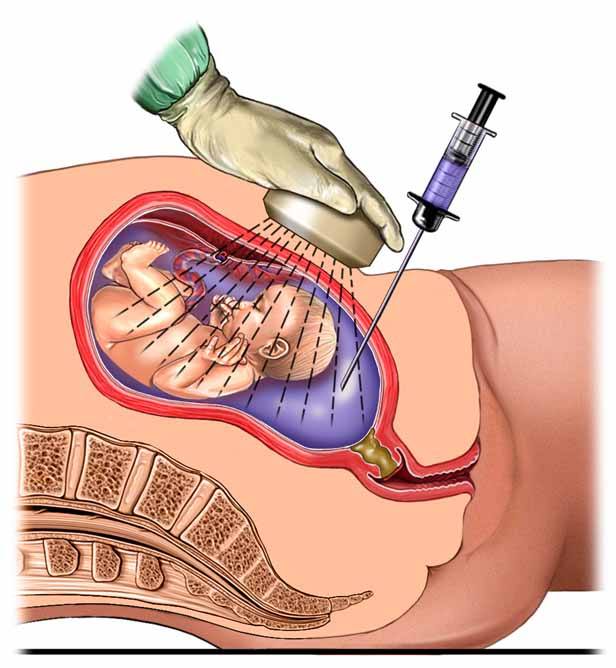 fdfcc1df24954c769d1e5ae615576fda.jpeg
