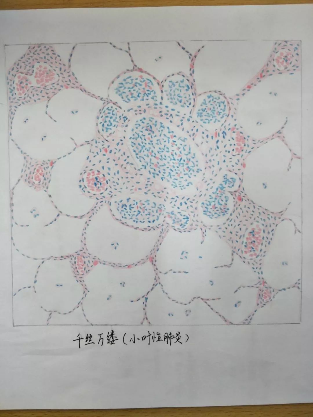 桂林医学院形态学兴趣协会病理学知识竞赛_作品