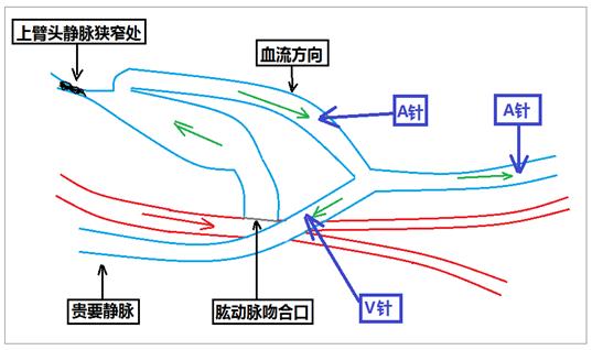 腕枕 血流