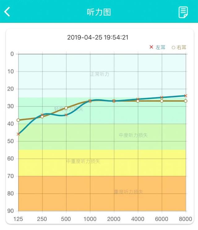 听力科普小知识