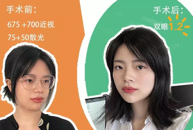 黑马眼科运营部何小富原作者:如果你年满18岁,近视1200度以下,相信看
