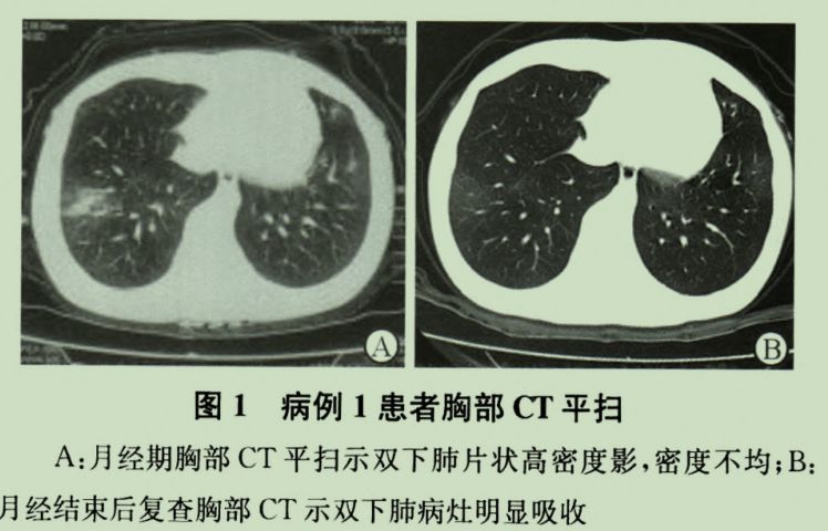 经期咳嗽怎么办