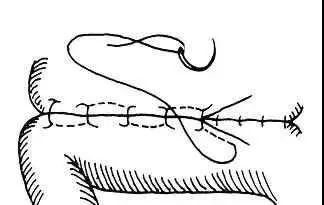 图文详解,详解各种外科缝合法_切口