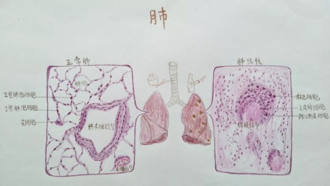 桂林医学院形态学兴趣协会病理学知识竞赛