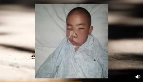                    男童患脸部肿瘤堪比“地壳运动”甚是可怖，却坚强阳光，笑面生活