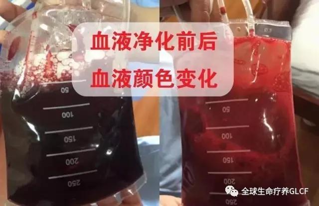 血液净化的作用是什么?