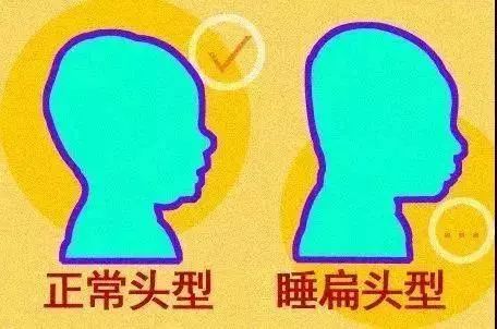 很多老人都喜欢给孩子睡"扁头",真的好吗?父母早知道早受益