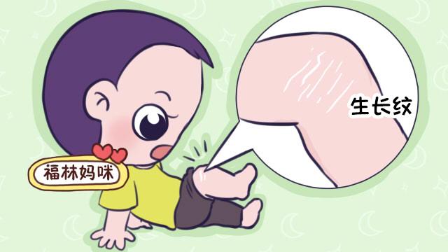                     孩子长得太快，膝盖都是难看的生长纹？教宝妈如何提前预防